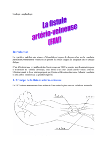 Introduction 1. Principe de la fistule artério-veineuse