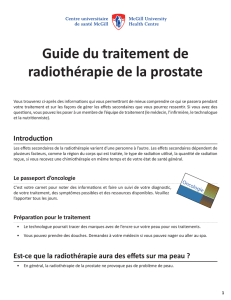PDF - Guide du traitement de radiothérapie de la prostate
