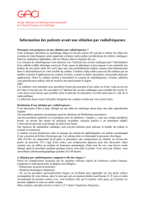 Information des patients avant une ablation par radiofréquence