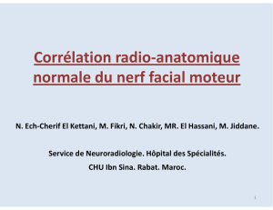 Corrélation radio-anatomique normale du nerf facial moteur