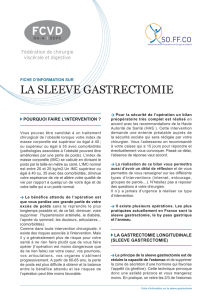 Fiche information sur la Sleeve gastrectomie