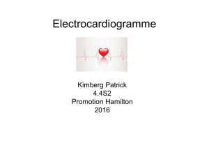 électrocardiogramme