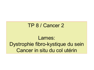 TP cancer 2 dystrophie mammaire KIS col