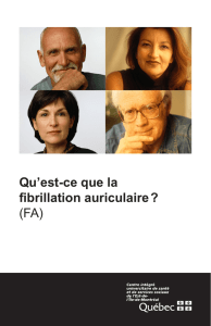 Qu`est-ce que la fibrillation auriculaire ? (FA)