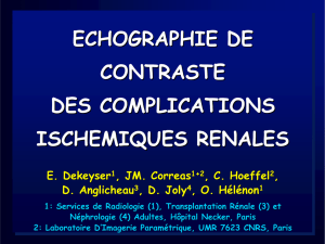 ECHOGRAPHIE DE CONTRASTE DES COMPLICATIONS