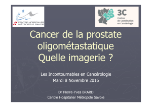 Cancer de la prostate oligo-métastatique, quelle imagerie - Dr P.