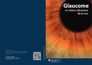 Glaucome - Fondation Asile des aveugles