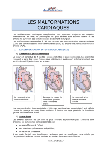 Les malformations cardiaques - agence