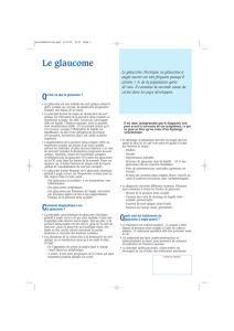 Le glaucome - Clinique Causse
