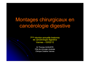 Dr AUGUSTE Montages chirurgicaux en cancérologie digestive