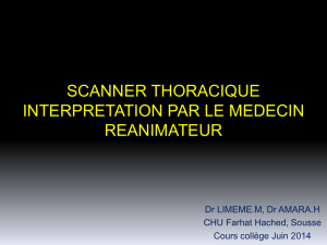 scanner thoracique interpretation par le reanimateur