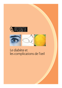 Le diabète et les complications de l`œil, Association pour la