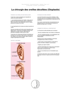 La chirurgie des oreilles décollées (Otoplastie)