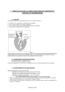 i. obstacles sur la voie d`ejection du ventricule gauche