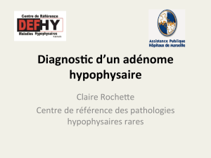 Diagnos(c d`un adénome hypophysaire - AP-HM