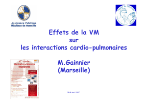 Effets de la VM sur les interactions cardio-pulmonaires