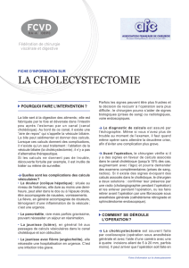 Fiche information sur la cholecystectomie