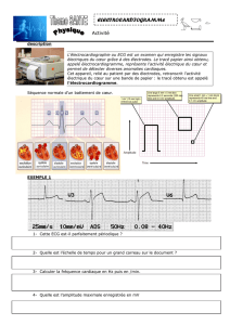 electrocardiogramme - Jf