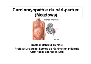 Cardiomyopathie du péri-partum (Meadows)