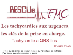 Tachycardie a QRS fins