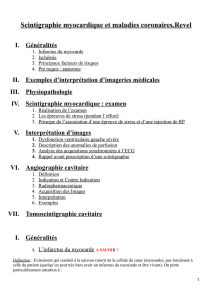 UE 5 : Revel - Scintigraphie myocardique et maladies coronaires