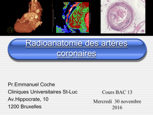 Anatomie artères coronaires