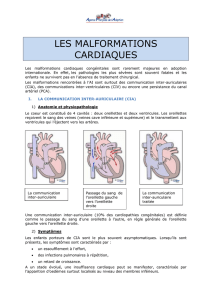 Malformations cardiaques - agence