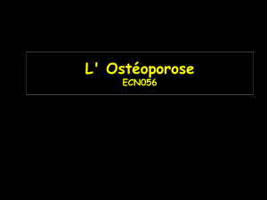 L` Ostéoporose