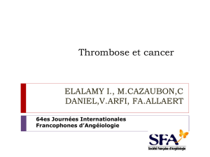 Thrombose et cancer
