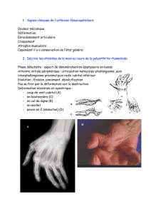 1. Signes cliniques de l`arthrose fémoropatellaire. Douleur