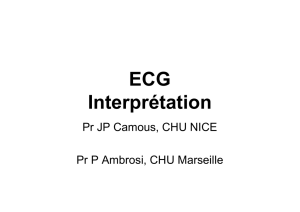 ECG Interpretation -JPC-PA [Mode de compatibilité]