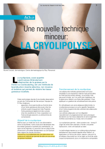 la cryolipolyse - Centre dermatologique du Roy