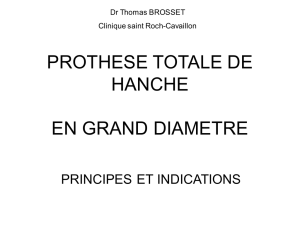 PROTHESE TOTALE DE HANCHE EN GRAND DIAMETRE