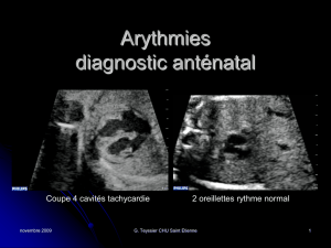 Rythme cardiaque fœtal Exploration , anomalies