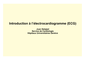 Introduction à l`électrocardiogramme (ECG)