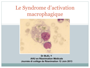 Syndrome d`activation macrophagique