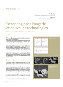 Otospongiose : imagerie et nouvelles technologies
