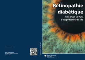 Rétinopathie diabétique - Fondation Asile des aveugles