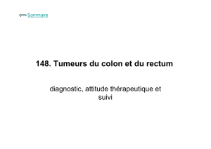 148. Tumeurs du colon et du rectum