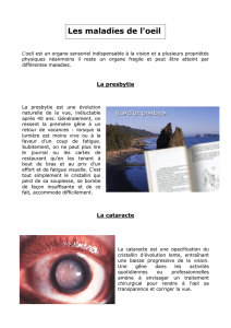 Les maladies de l`oeil - Lycée Lavoisier Mulhouse