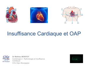 Insuffisance Cardiaque et OAP