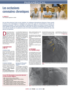 Les occlusions coronaires chroniques