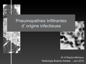 Pneumopathies Infiltrantes d`origine infectieuse