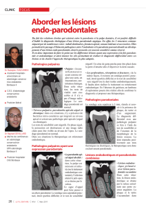 Aborder les lésions endo-parodontales