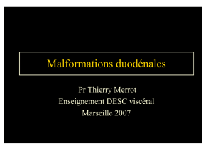 malformation duodénale