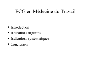 ECG en Médecine du Travail