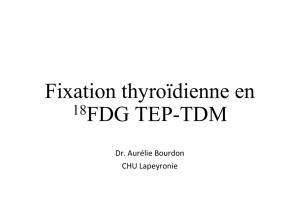 Fixation thyroïdienne en TEP au 18F-FDG