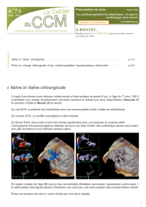 Valve in Valve chirurgicale - Centre Cardio