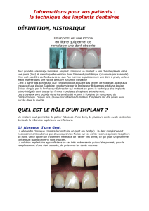 Informations pour vos patients : la technique des implants dentaires