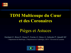 TDM Multicoupe du Cœur et des Coronaires Pièges et Astuces
